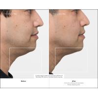 Product 9 image
