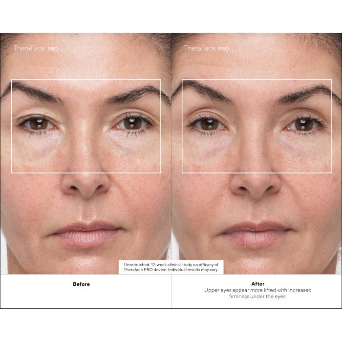 Image 12 numéro de produit