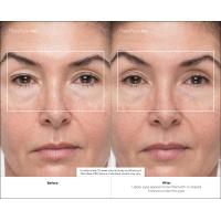 Immagine 12 del prodotto